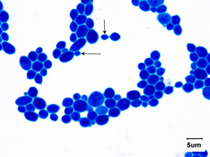 Photomicrograph of a direct stain of <i>Saccharomyces cerevisiae</i> showing budding yeast.